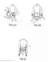Fig. 02 - MULTIFUNCTION JOINT BRACE