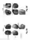 Fig. 20 - Methods for administration and methods for treating cardiovascular diseases with resiniferatoxin