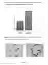 Fig. 04 - Method of treating focal segmental glomerulosclerosis
