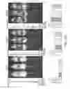 Fig. 57 - COMBINATION OF CHIMERIC ANTIGEN RECEPTOR THERAPY AND AMINO PYRIMIDINE DERIVATIVES