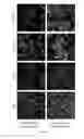 Fig. 08 - Anticancer adjuvant containing panaxadiol ginsenocide compound