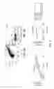 Fig. 05 - MICROVESICLES ISOLATED FROM MESENCHYMAL STEM CELLS FOR USE AS IMMUNOSUPPRESSIVE AGENTS