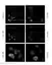 Fig. 08 - MICROVESICLES ISOLATED FROM MESENCHYMAL STEM CELLS FOR USE AS IMMUNOSUPPRESSIVE AGENTS