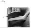 Fig. 03 - Hand wrap including eucalyptus oil