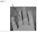 Fig. 04 - Hand wrap including eucalyptus oil