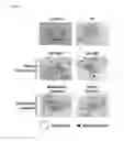 Fig. 07 - Method of treating a wound, comprising the step of administering a composition including a substance P