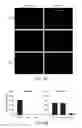 Fig. 09 - Composition comprising connective tissue growth factor (CTGF) for cardiac tissue repair