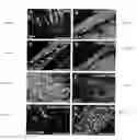 Fig. 15 - Composition comprising connective tissue growth factor (CTGF) for cardiac tissue repair
