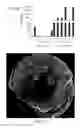 Fig. 16 - Composition comprising connective tissue growth factor (CTGF) for cardiac tissue repair