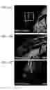 Fig. 19 - Composition comprising connective tissue growth factor (CTGF) for cardiac tissue repair