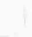 Fig. 06 - Directed stem cell recruitment