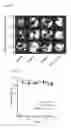 Fig. 13 - MODULATION OF AXL RECEPTOR ACTIVITY IN COMBINATION WITH CYTOREDUCTIVE THERAPY