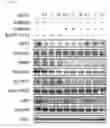 Fig. 14 - MODULATION OF AXL RECEPTOR ACTIVITY IN COMBINATION WITH CYTOREDUCTIVE THERAPY