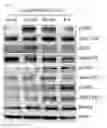 Fig. 16 - MODULATION OF AXL RECEPTOR ACTIVITY IN COMBINATION WITH CYTOREDUCTIVE THERAPY