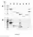 Fig. 10 - Group A Streptococcus Pharmaceutical Compositions and Methods Thereof