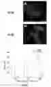 Fig. 12 - Shape memory particles for biomedical uses