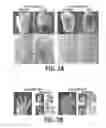 Fig. 05 - COMPOSITIONS AND METHODS FOR TISSUE REGENERATION