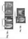 Fig. 28 - COMPOSITIONS AND METHODS FOR TISSUE REGENERATION