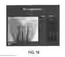 Fig. 40 - COMPOSITIONS AND METHODS FOR TISSUE REGENERATION