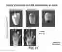 Fig. 74 - COMPOSITIONS AND METHODS FOR TISSUE REGENERATION