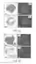 Fig. 06 - IMAGING OF TUMOR-ASSOCIATED MACROPHAGES