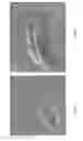 Fig. 06 - HAEMOSTATIC DEVICE