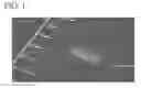 Fig. 02 - GRAFT MATERIAL FOR NERVE REGENERATION, METHOD FOR PRODUCING GRAFT MATERIAL FOR NERVE REGENERATION, AND KIT FOR PRODUCING GRAFT MATERIAL FOR NERVE REGENERATION
