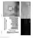 Fig. 02 - Enhancement of osteogenic potential of bone grafts