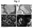 Fig. 04 - POROUS MATRIX WITH INCORPORATED CELLS
