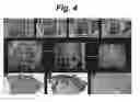 Fig. 05 - POROUS MATRIX WITH INCORPORATED CELLS