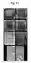 Fig. 12 - POROUS MATRIX WITH INCORPORATED CELLS