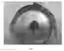 Fig. 04 - Lyophilized moldable implants containing an oxysterol