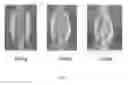 Fig. 07 - Lyophilized moldable implants containing an oxysterol