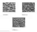Fig. 04 - Implantable medical device