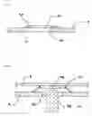 Fig. 05 - Device for drainage, in particular for the drainage of a chronic subdural hematoma