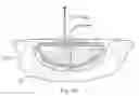 Fig. 24 - Wound treatment apparatus and method
