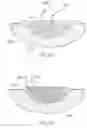 Fig. 25 - Wound treatment apparatus and method
