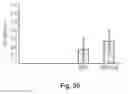Fig. 32 - Wound treatment apparatus and method