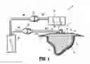 Fig. 02 - System for providing continual drainage in negative pressure wound therapy