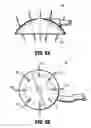 Fig. 07 - System for providing continual drainage in negative pressure wound therapy