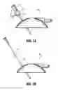 Fig. 08 - System for providing continual drainage in negative pressure wound therapy