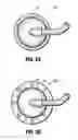 Fig. 09 - System for providing continual drainage in negative pressure wound therapy