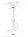 Fig. 06 - Pulmonary embolism apparatus