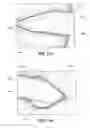 Fig. 101 - Positioning and stabilising structure and patient interface