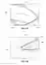 Fig. 102 - Positioning and stabilising structure and patient interface