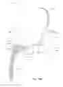 Fig. 131 - Positioning and stabilising structure and patient interface