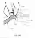 Fig. 147 - Positioning and stabilising structure and patient interface