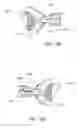 Fig. 148 - Positioning and stabilising structure and patient interface