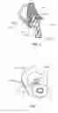 Fig. 18 - Positioning and stabilising structure and patient interface