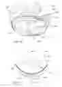 Fig. 20 - Positioning and stabilising structure and patient interface